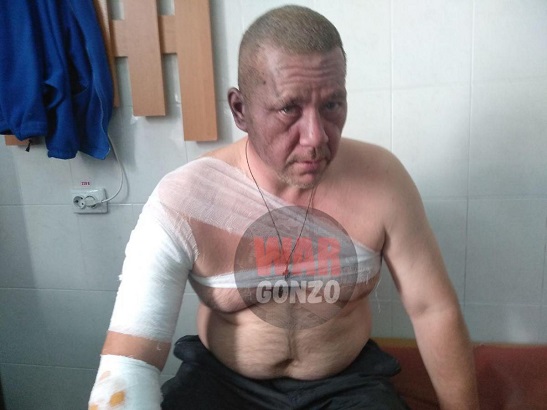 Від вибуху в окупованому Донецьку обгорів комуніст Хакімзянов, який претендує на пост “глави” фейкової “ДНР”